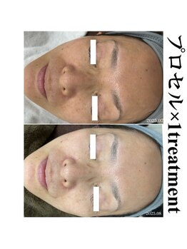 ヒルナム(Heal Nam)/プロセルセラピーズ~フェイス~