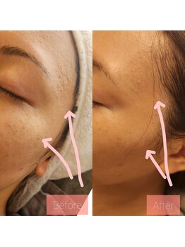 ビューティールームウィズ(beauty room w/)/韓国　美肌管理　【ララピール】