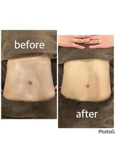 バーン 長崎 諫早(BURN)/ハイパーナイフbeforeafter☆