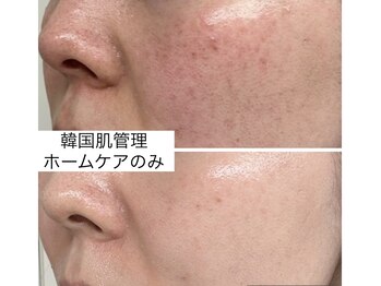 フリーシャ いせさき店(freesha)/【ゆうみ指名】カウンセリング