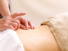 ひがし鍼灸整骨院 森ノ宮院の雰囲気（鍼灸施錠も可能です。【整体/鍼灸/マッサージ/肩こり/腰痛】）