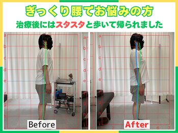 いお整体院の写真/《腰の重だるさ・違和感に》動き始めの痛みや慢性的な症状に特化した｜セカンドオピニオン専門整体