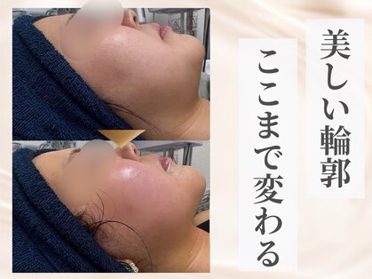 ザ ピーチ(THE PEACH)の写真