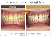 ピュアホワイトニング 横浜店の雰囲気（歯科提携セルフホワイトニングの驚きの白さを実感してください。）