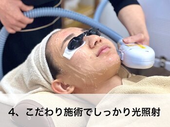 ラウレア(LAULEA)/4：こだわり施術でしっかり照射
