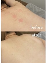 チル(chill)/ビフォーアフター