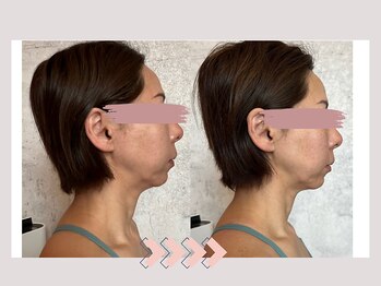 サリー(Sally)/美姿勢・小顔