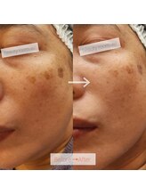 ビューティールームウィズ(beauty room w/)/韓国　美肌管理　【ララピール】