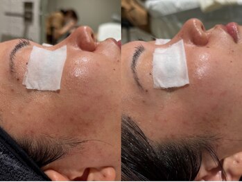 フロムミー 銀座本店(FROM ME)/リフィル