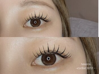 アニュレア バイ レヴィエリス(Anurea by Re’VIELISS)/フラットラッシュ140本