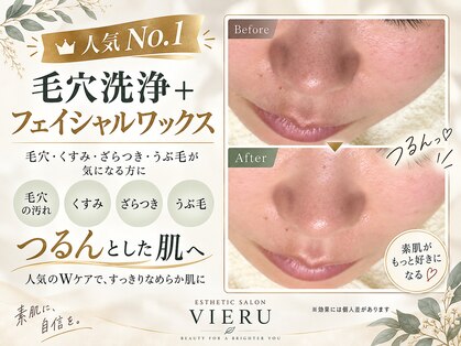 ビエル(VIERU)の写真