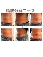 アットホーム 新鎌ヶ谷店(At-home)/脂肪分解コース