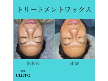 アクト クロ(ACT curro)/【フェイシャル】施術例