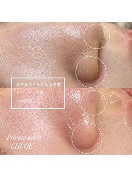 クロエ(CHLOE)/美肌フェイスワックス