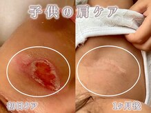 サロンデュヒャーク 志木駅前店(salon du ひゃーく)/お肌のお悩み解決に自信アリ！