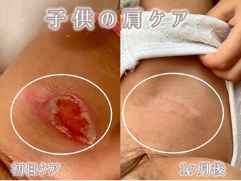 サロンデュヒャーク 志木駅前店(salon du ひゃーく)/お肌のお悩み解決に自信アリ!