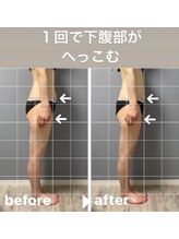 メゾン ド クロエ(Maison de Chloe)/CHLOE式パーソナル痩身