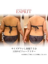 エスプリ 銀座店/背中やせ・ウエストくびれ