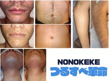 ノノケケ(NONOKEKE)の雰囲気（メンズ脱毛♪人気No.1「ひげ」脱毛。肌荒れ・毛量等のお悩み解消）
