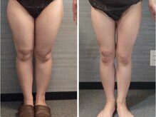 美容整体ウェリナ 中川八田院/小顔矯正/骨盤矯正/痩身整体