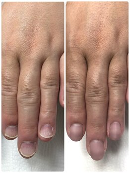 エルナ(elna)/自信を持てる手元になります