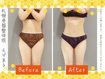 エゾマル(Ezo-maru)/【施術例】ビフォーアフター