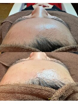 クラルス(Clarus)/フェイシャルwax