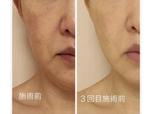 アリビオ(alivio)の雰囲気（年齢を重ねたお肌を引き上げうるおいを与えます。）