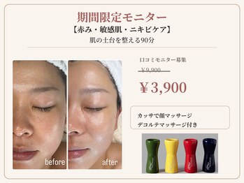 リベレ(Libelle)の写真/今だけ特別価格【3,900円】韓国のエステ商材を使用しあなたの悩みの毛穴・赤み・くすみにアプローチ