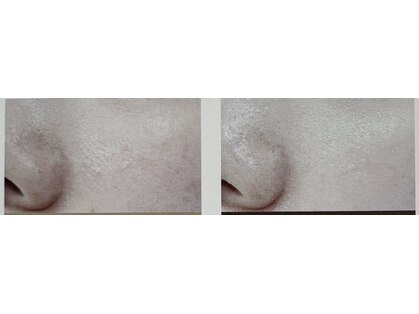 サロンつぼみの写真