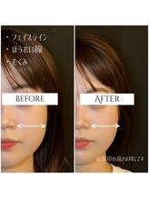 クク 赤坂 天神(99 KUKU)/【小顔】