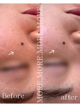 モア 吉祥寺(MORE.)/Before after