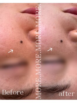 モア 吉祥寺(MORE.)/Before after