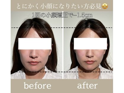 ユウサク(Yusaku)の写真