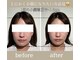 ユウサク(Yusaku)の写真