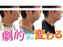 ターン(TERN)の雰囲気（小顔矯正とレモンボトルの組み合わせで引き締まった小顔に◎）