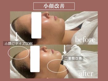 上野エステサロン レア(Lea)