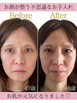 ココロ(COCORO)/セルラム ビフォーアフター