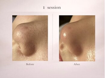 ベルミナ(Belmina)/