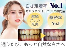LBSホワイトニング 梅田店
