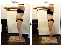 ビューティークリニックコダマ 高鍋店/【2か月コース】M.N 様 （38歳）