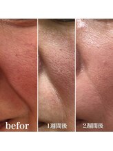 プレシャスサロン(precious salon)/インフィニット＆エンパイア