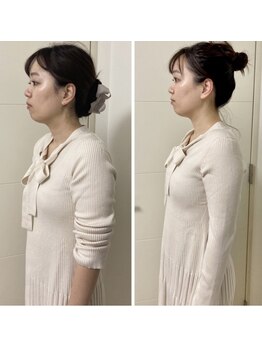 蒼(so)/全身バランス矯正・小顔矯正