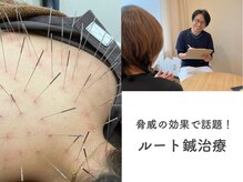 はり処せと