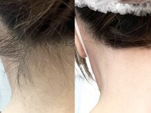 ラニブロウ(Lani brow)/もみあげが濃い方は♪