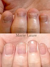マリーロール 梅田店(Marie Laure)/深爪矯正/自爪育成/自爪風