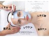 【最強美白・透明感】高濃度ビタミンC30%　美白に特化したトリートメント