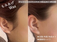 アルム(a'lm)の雰囲気（［フェイシャルワックス］もみあげワックス/肌質改善/毛穴/小顔）