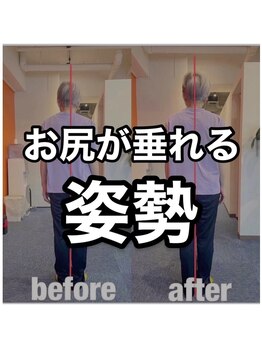 カワル整体 上通り院/お尻が垂れる人の特徴