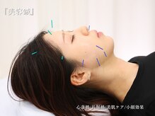 アロエ鍼灸整体院/美容鍼で肌質改善